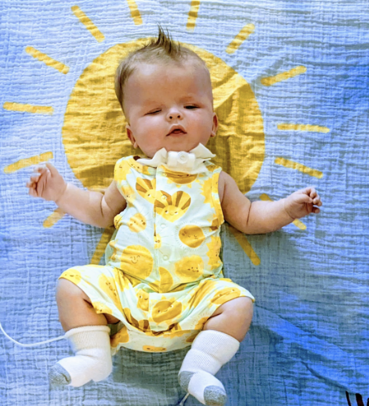 Baby laying on a sunshine blanket on his back